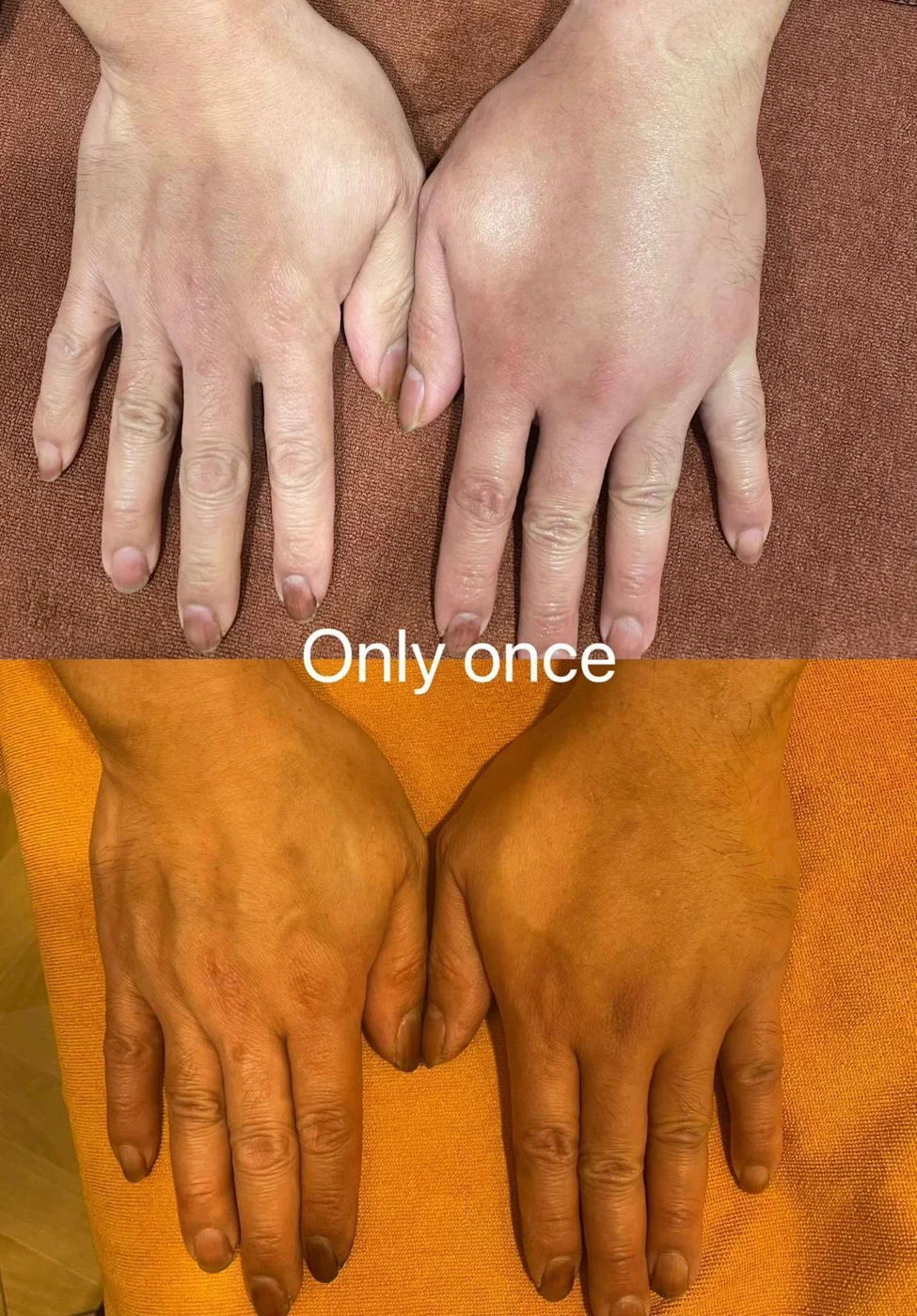 Hand care: original treatment comparison, with its original labels