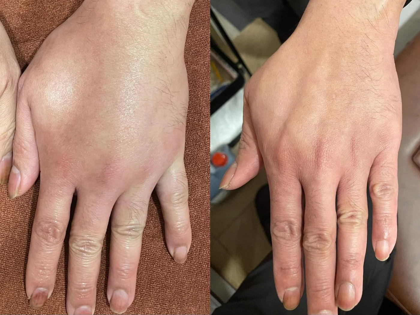 Hand care: original treatment comparison, with its original labels