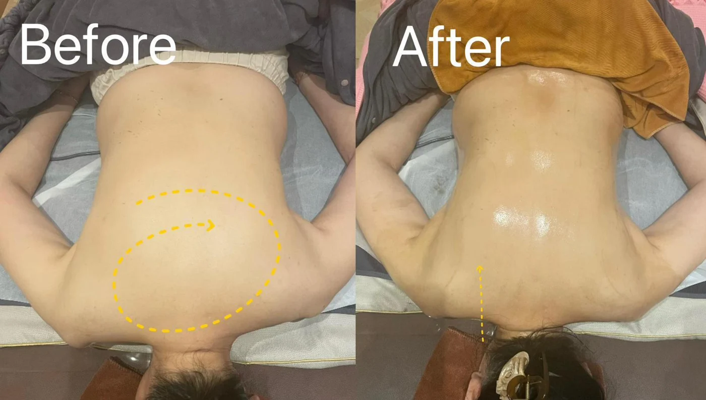 Back & posture care: original treatment comparison, with its original labels